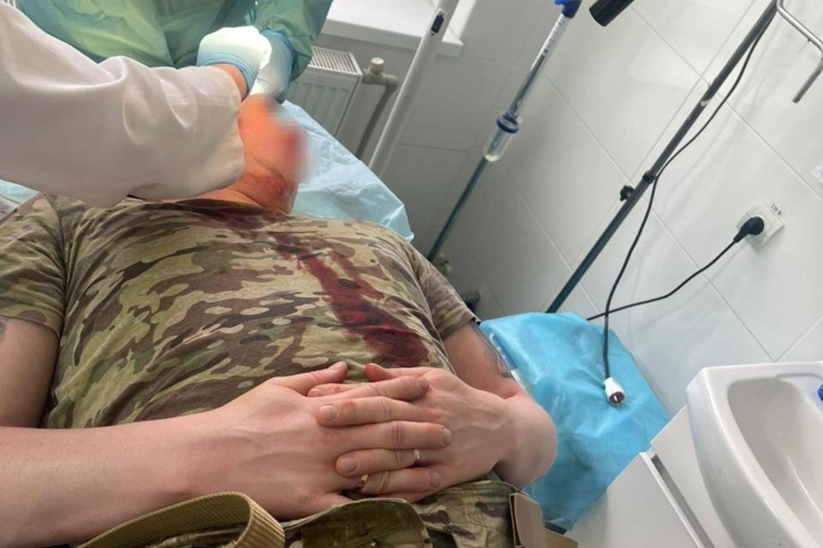 Нелегальные переправы переросли в насилие – пограничники в больнице после жестокого нападения / Фото: Facebook ГНСУ Нелегальные переправы переросли в насилие – пограничники в больнице после жестокого нападения