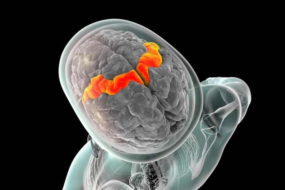 Искусственный интеллект вернул пациенту возможность говорить/Фото: Nature Искусственный интеллект вернул пациенту возможность говорить