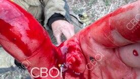 В Криворожском районе застрелили мужчину, который поджег сено и напал на людей В Криворожском районе застрелили мужчину, который поджег сено и напал на людей