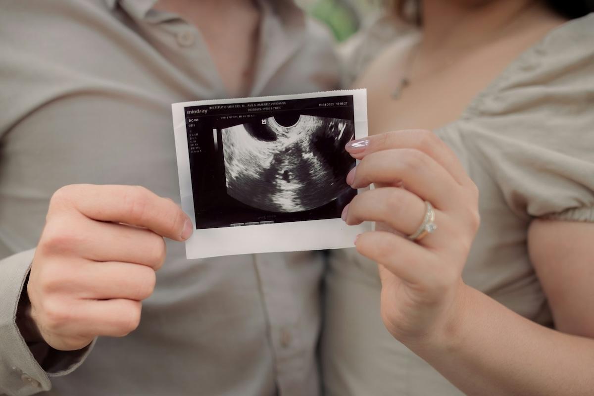 Хто має право зберегти репродуктивні клітини/Фото: Unsplash Зберегти майбутнє: хто може скористатися програмою збереження репродуктивних клітин