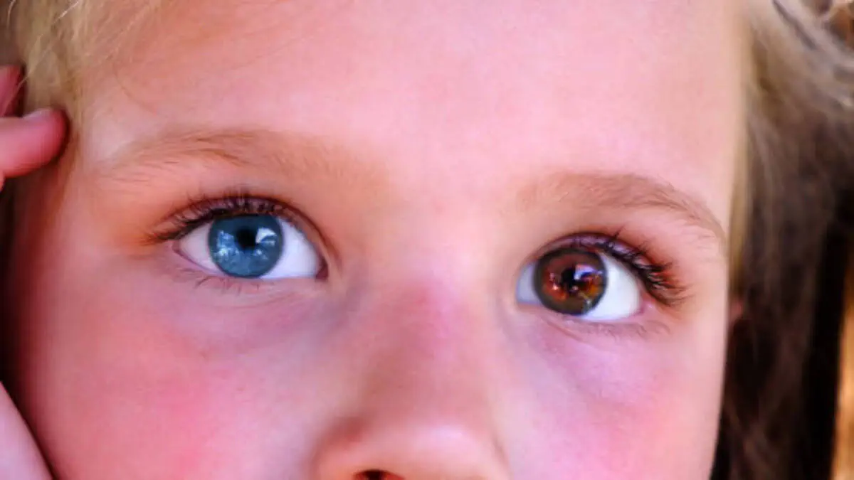 Вопреки прогнозам: этот чудо-ребенок выжил, несмотря на диагнозы врачей