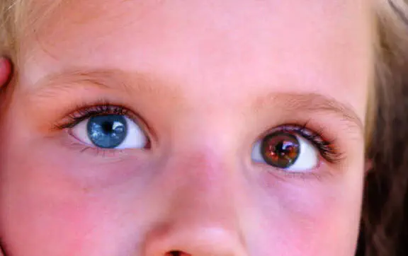 Вопреки прогнозам: этот чудо-ребенок выжил, несмотря на диагнозы врачей