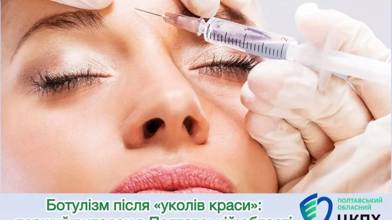 Краса, що ледь не коштувала життя: на Полтавщині зафіксували рідкісний ботулізм від «уколу краси»