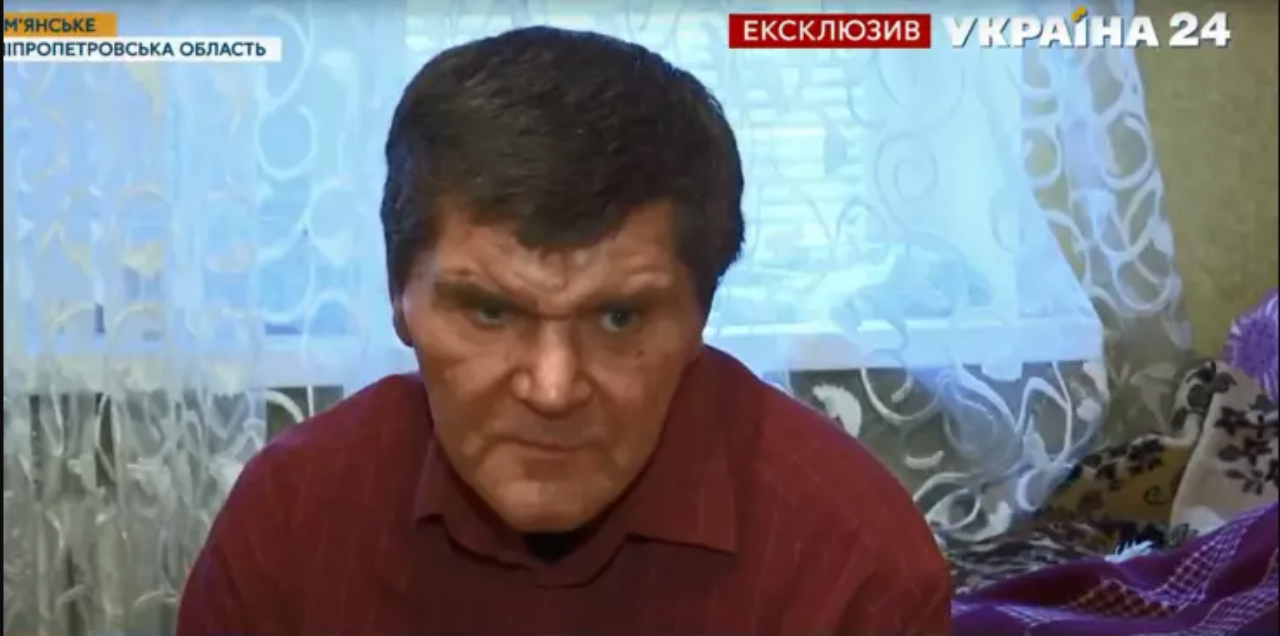Чоловіка помилково визнали мертвим