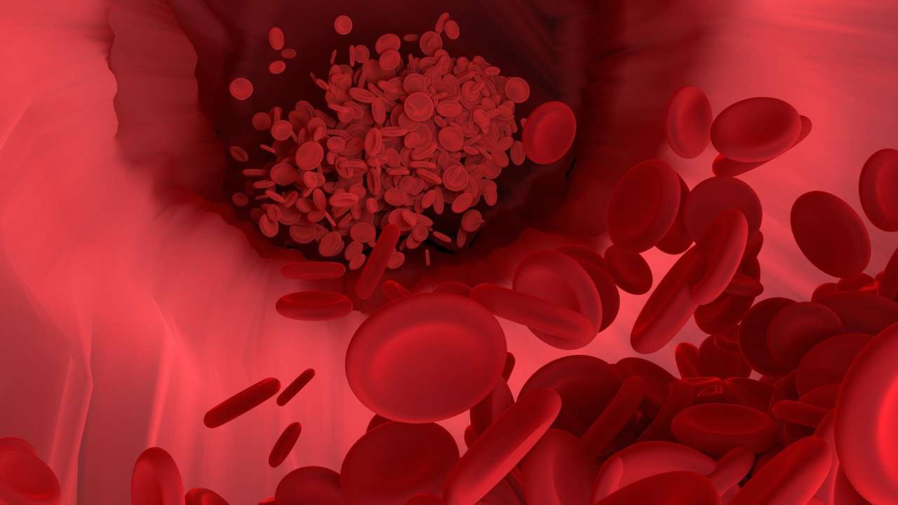 Фото: Pixabay/Автор — Vector8DIY 5 перевірених способів знизити високий рівень холестерину в організмі