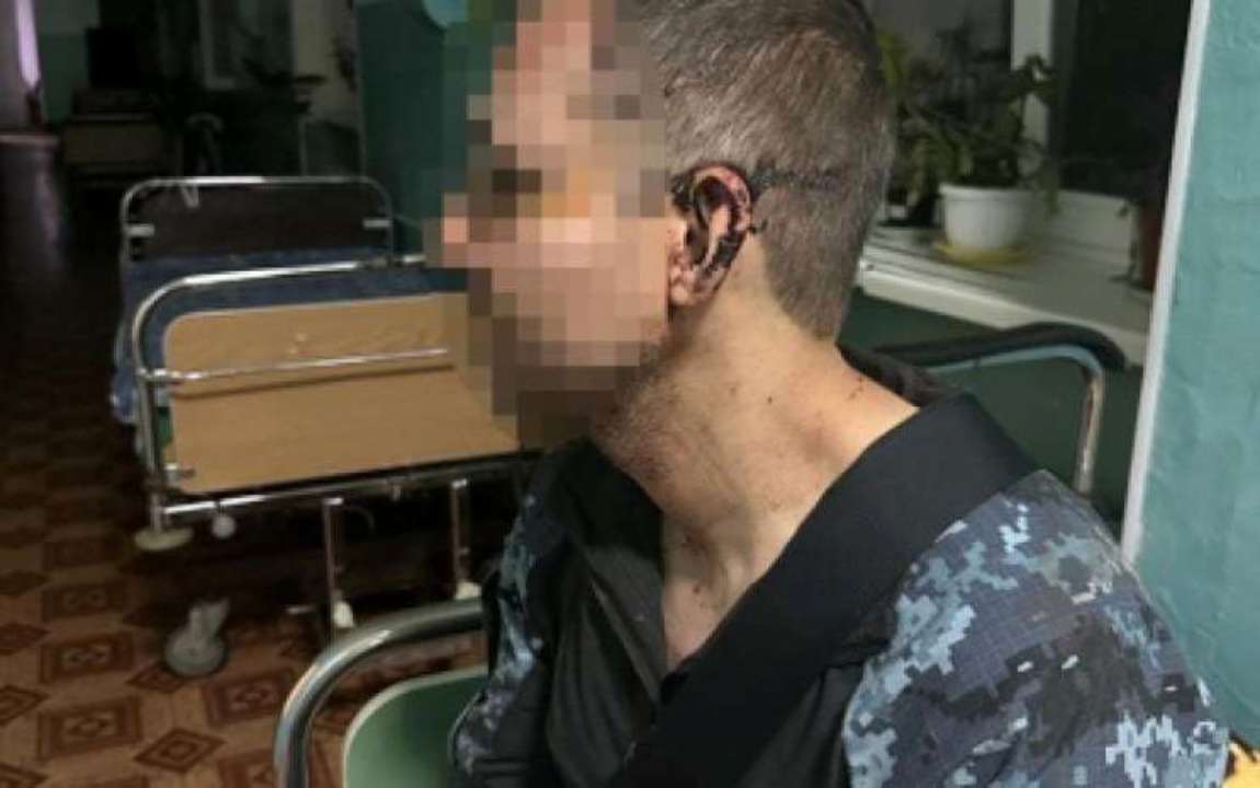 ГБР расследует избиение военного в Одесской области