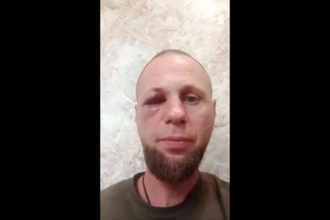 У Смілі чоловік побив військовослужбовця на лікуванні/Фото: кадр з відео У Смілі чоловік побив військовослужбовця на лікуванні/Фото: кадр з відео