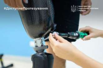 За протез платить не нужно За протез платить не нужно