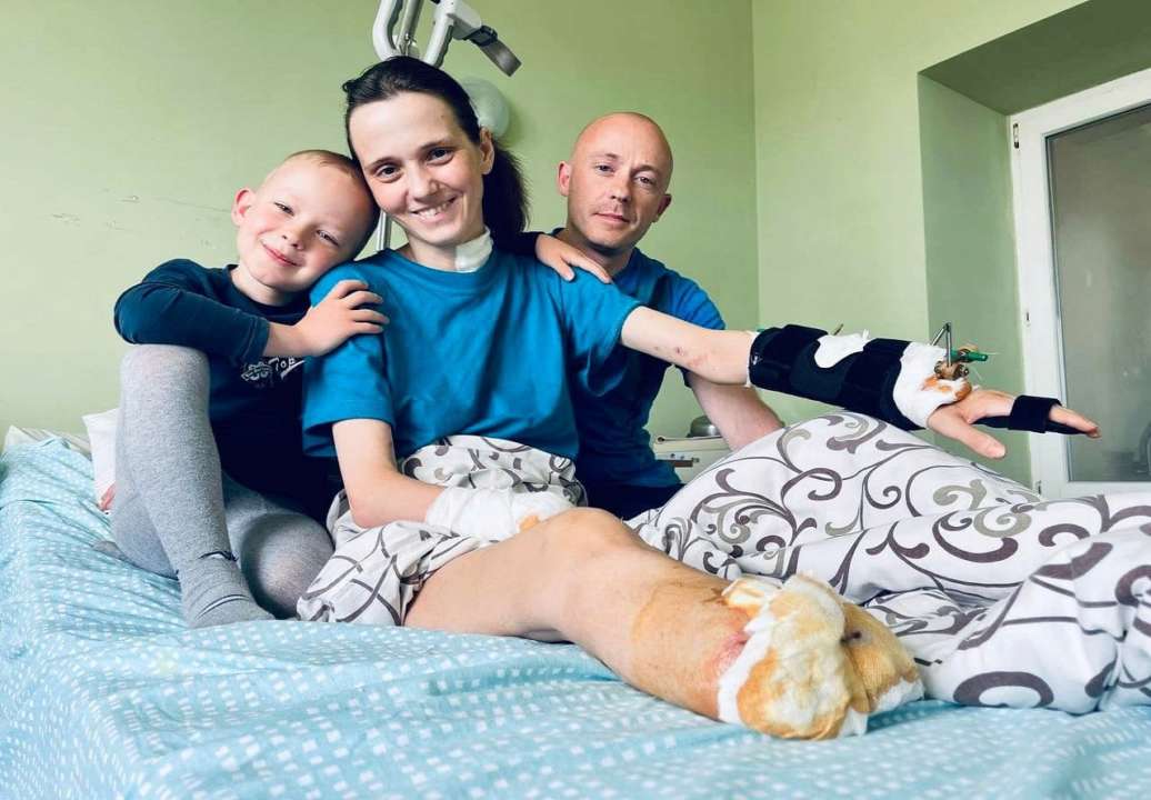 Російська ракета забрала в українки руку, ногу та дитину/Фото: Перше медичне об'єднання Львова
