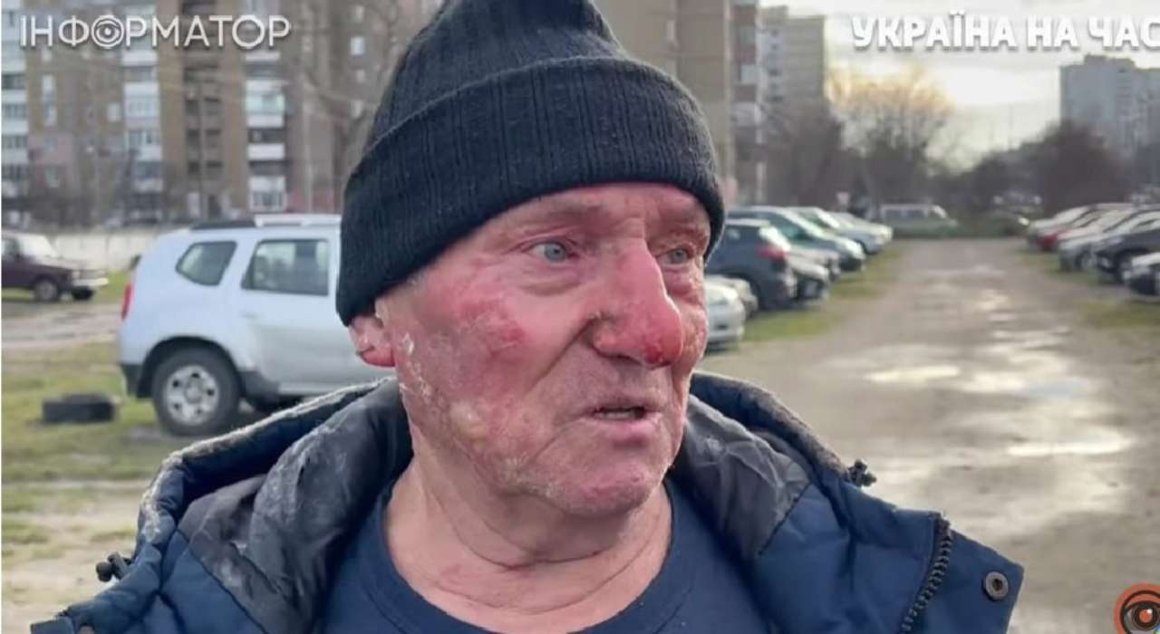 Василь Андрійович Київ палаюче авто обстріли