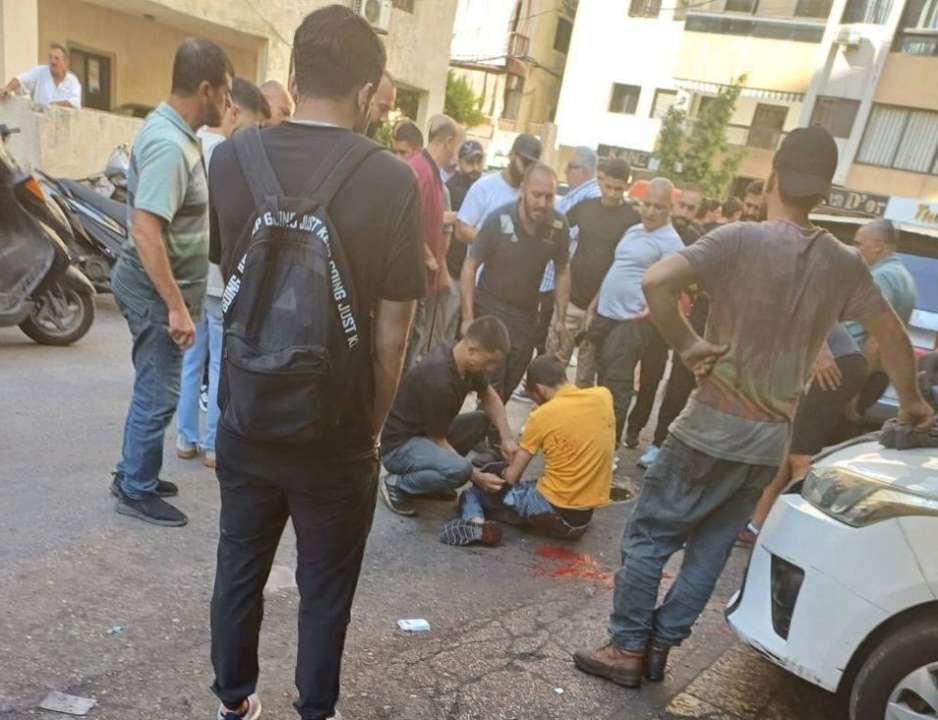 У багатьох бойовиків "Хезболли" вибухнули пейджери/Фото: соцмережі