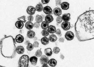 Японские ученые успешно испытали вакцину от ВИЧ/Фото: U.S. Centers for Disease Control and Prevention Вирус