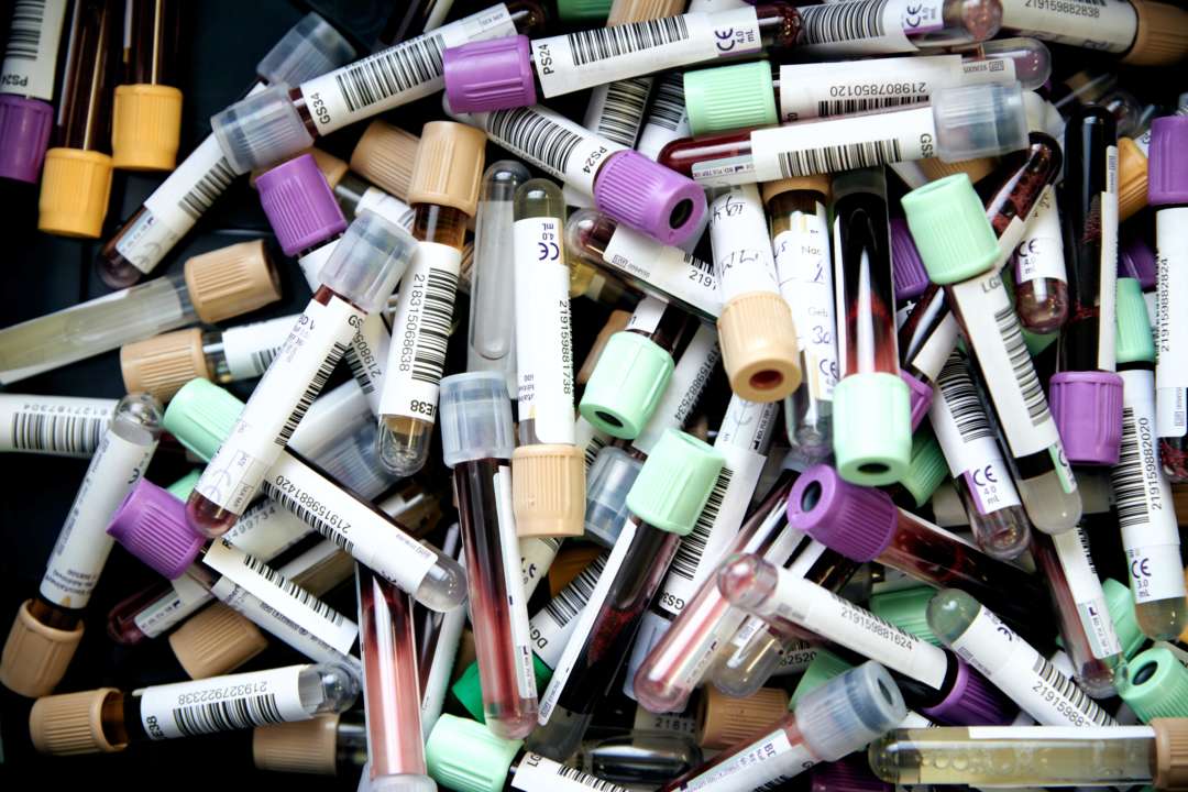 В мире выявлено рекордное количество заражений коронавирусом за сутки