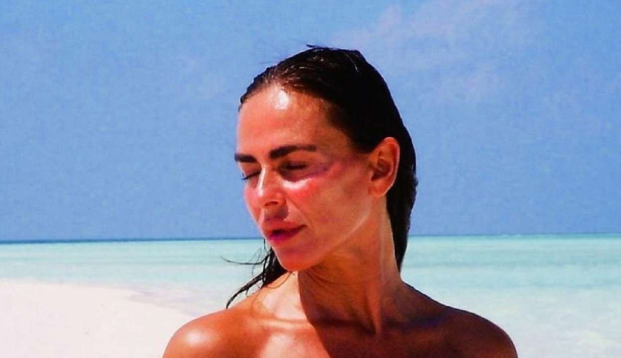 Топ-5 знаменитых женщин, которых изуродовала пластическая хирургия/Фото: instagram Топ-5 знаменитых женщин, которых изуродовала пластическая хирургия