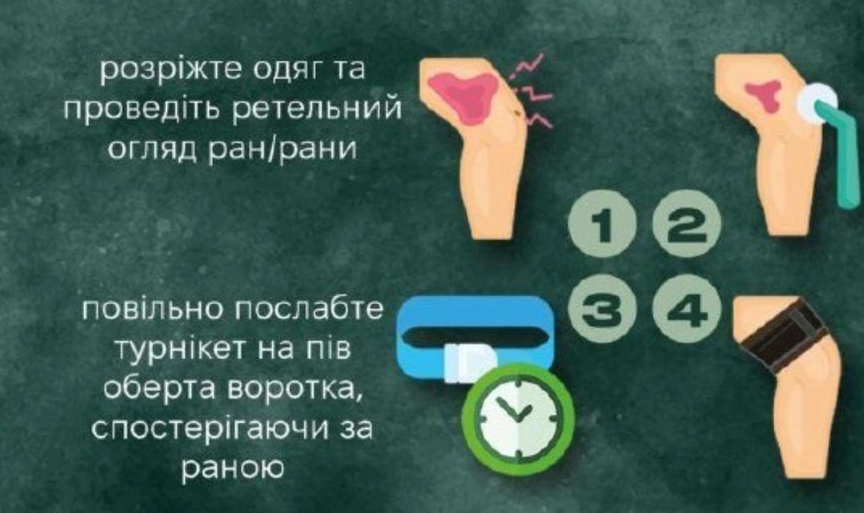 Как помочь раненому бойцу как спасти раненую конечность