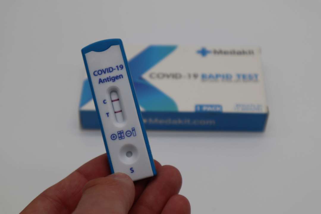 Covid-19 в Україні: показники захворюваності поступово знижуються