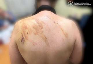 Працівниця психоневрологічного інтернату Коломиї побила підопічну/Фото: Дмитро Лубінець Працівниця психоневрологічного інтернату Коломиї побила підопічну/Фото: Дмитро Лубінець