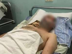 pol.kyivregion На Київщині п'яні хлопець та дівчина пограбували перехожого, який теж був під градусом