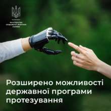 Возможности протезирования в Украине расширились / Фото: t.me/MinSocUA Возможности протезирования в Украине расширились / Фото: t.me/MinSocUA