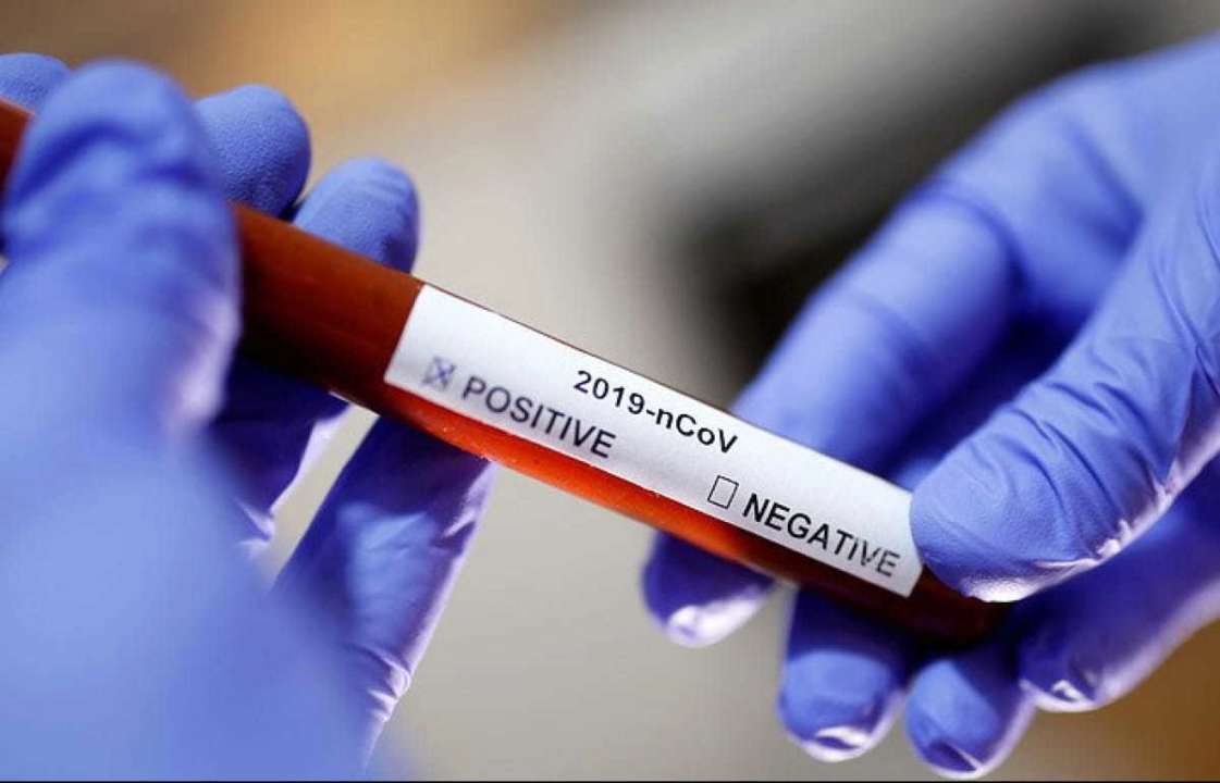 В мире уже больше 106 млн заболевших коронавирусом