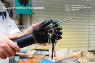 На бесплатный протез имеют право абсолютно все украинцы, не только военные На бесплатный протез имеют право абсолютно все украинцы, не только военные