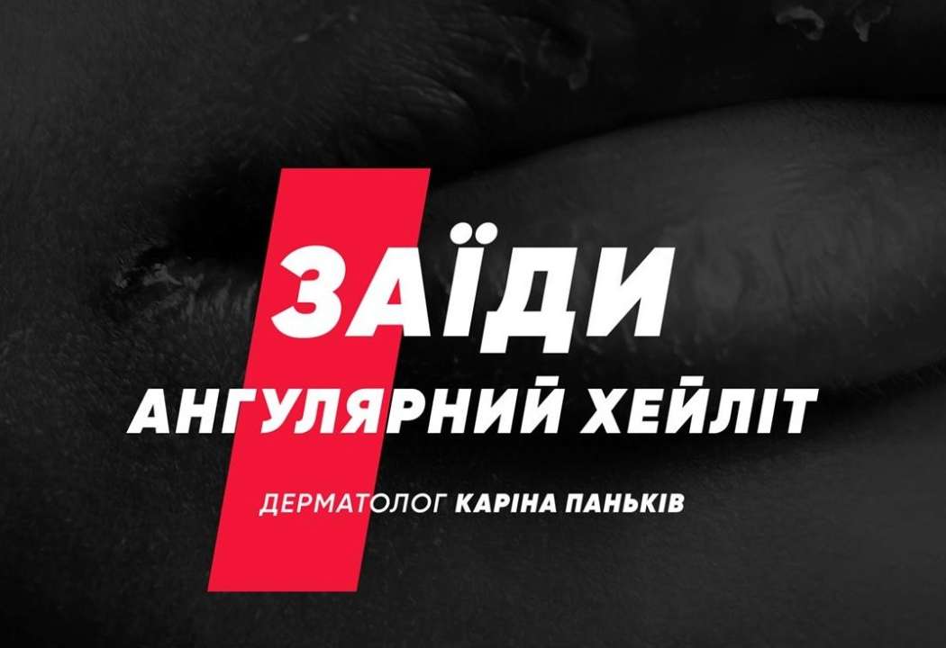 Як лікувати? Як лікувати?