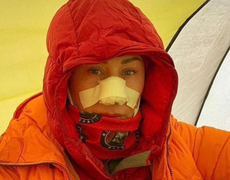 Жена мэра Днепра пострадала во время похода в горы / Фото: Instagram Марина Филатова