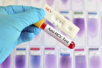 У регіонах можна буде здати експрес-аналіз на гепатити / Фото: ganeshdiagnostic.com У регіонах можна буде здати експрес-аналіз на гепатити / Фото: ganeshdiagnostic.com