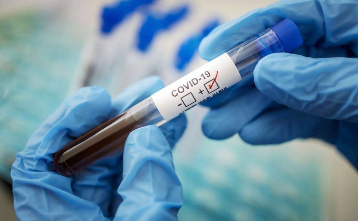 Covid-19 в Украине: почти 5 тысяч новых заражений
