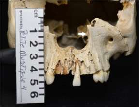 Археологи обнаружили 200-летний череп прокаженной женщины/Фото: Sciencedirect Археологи обнаружили 200-летний череп прокаженной женщины